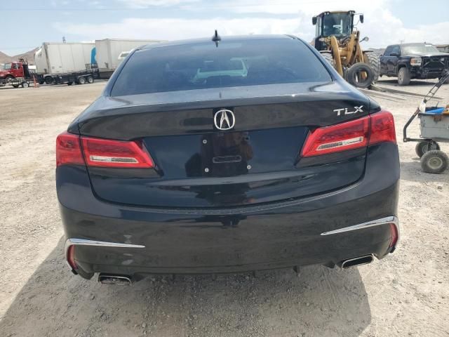 2019 Acura TLX Technology