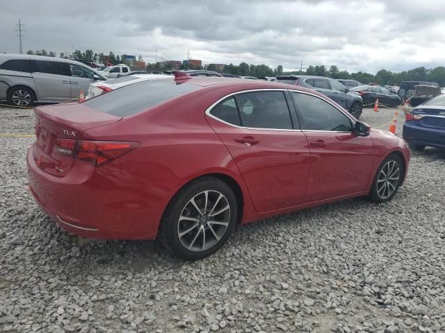 2017 Acura TLX Tech