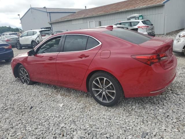 2017 Acura TLX Tech