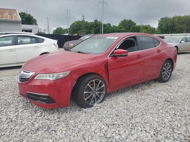 2017 Acura TLX Tech