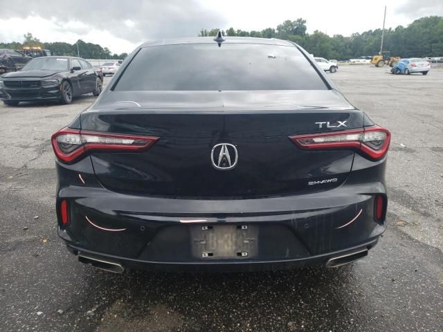 2021 Acura TLX Technology