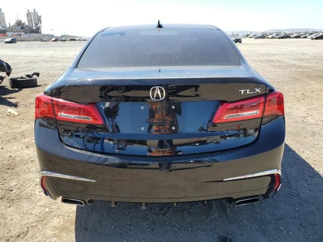 2019 Acura TLX Technology