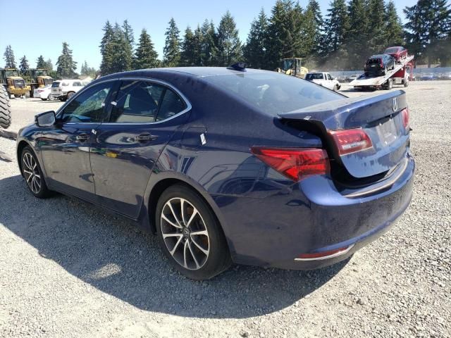 2015 Acura TLX Tech