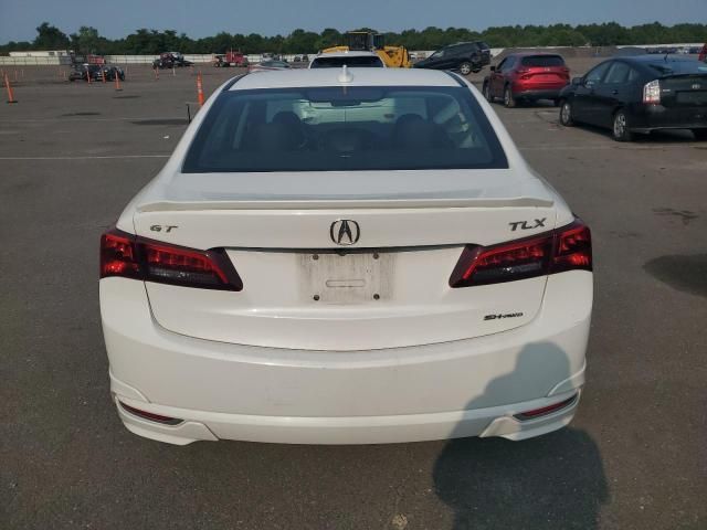 2017 Acura TLX Tech