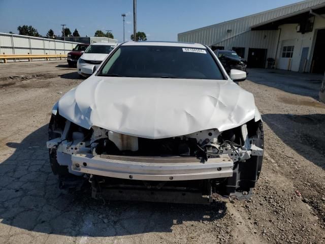 2015 Acura TLX Tech