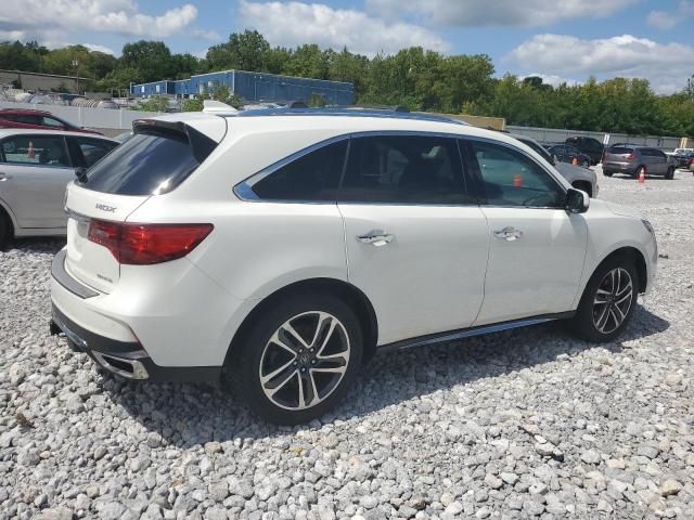 2017 Acura MDX Advance