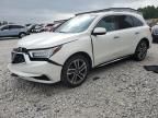 2017 Acura MDX Advance