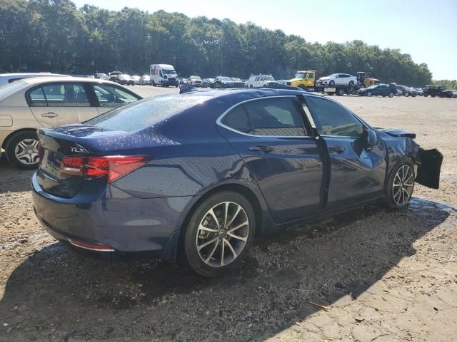 2015 Acura TLX Tech