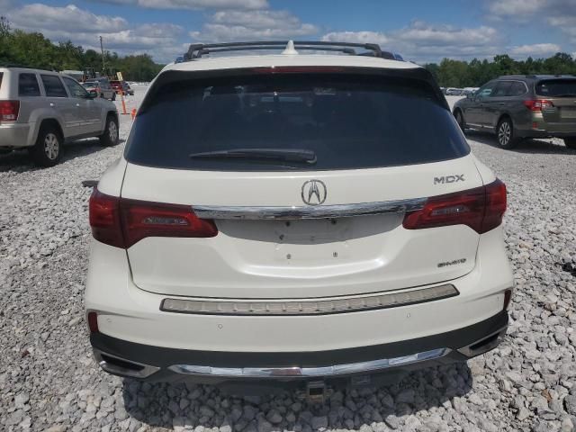 2017 Acura MDX Advance