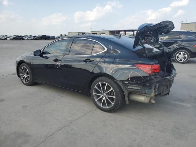 2015 Acura TLX Tech