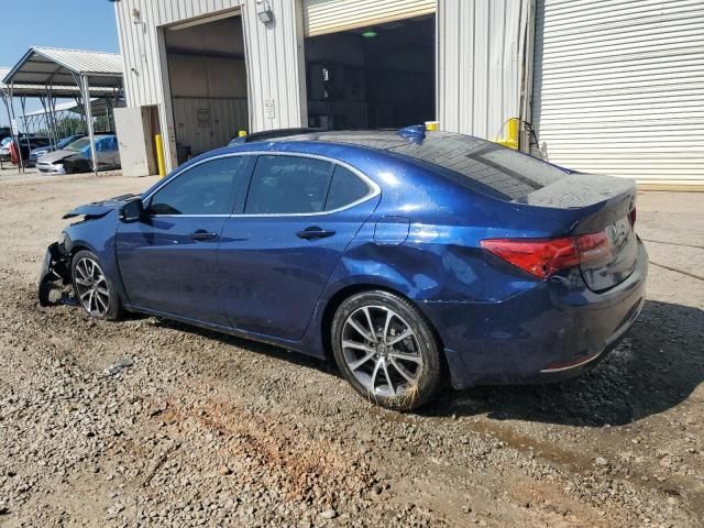 2015 Acura TLX Tech