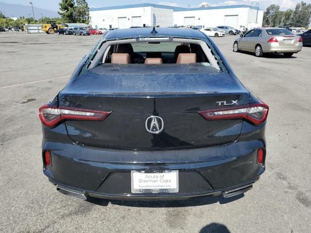 2021 Acura TLX Technology