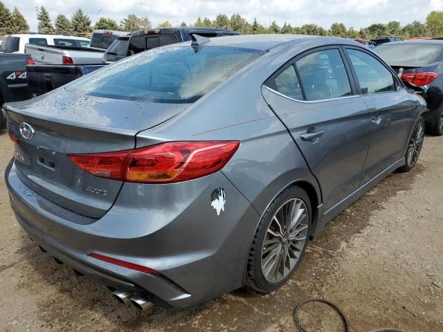 2017 Hyundai Elantra Sport