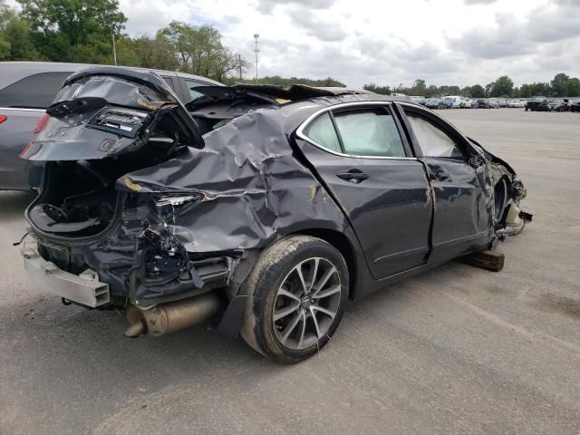 2015 Acura TLX Advance