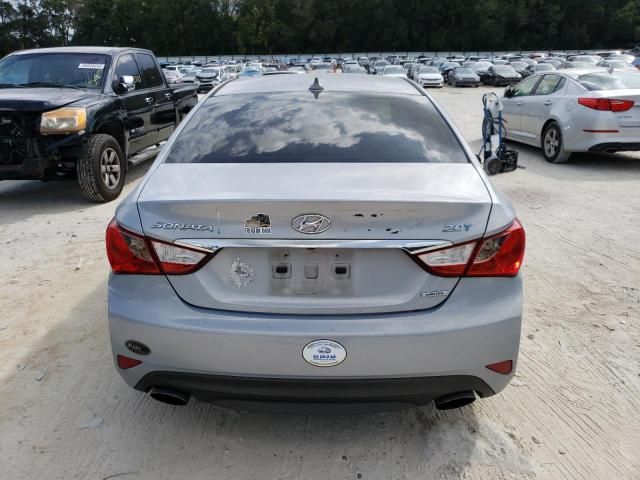 2014 Hyundai Sonata SE