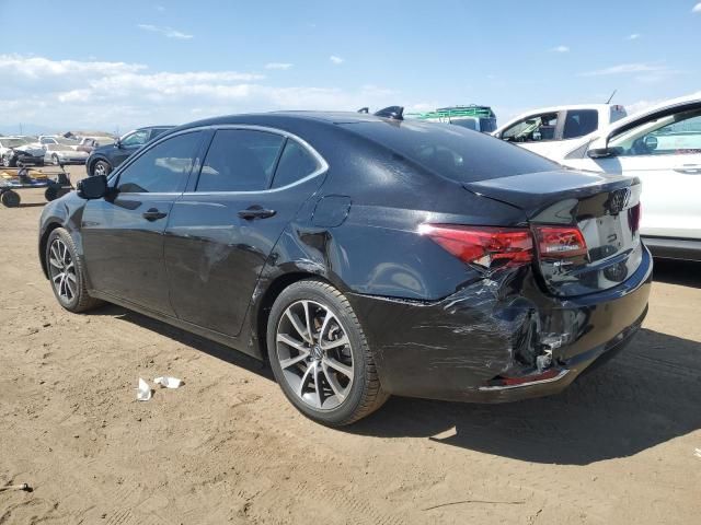 2015 Acura TLX Advance