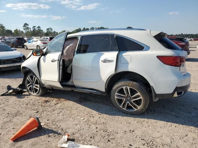 2017 Acura MDX Advance