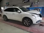 2015 Acura MDX Advance