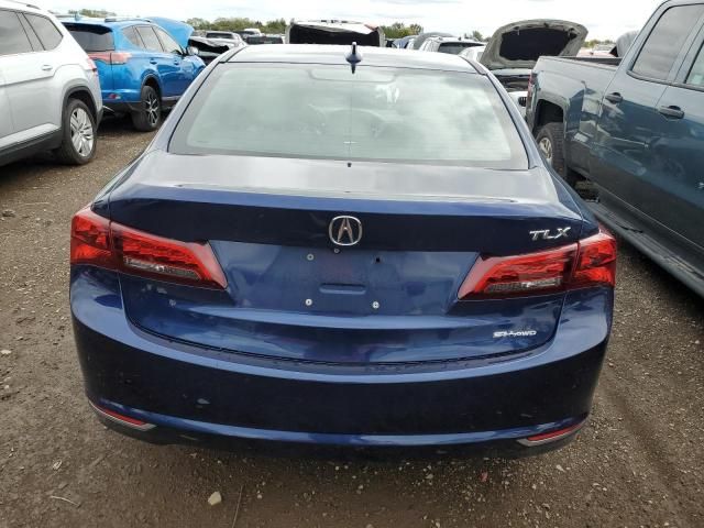 2015 Acura TLX Tech