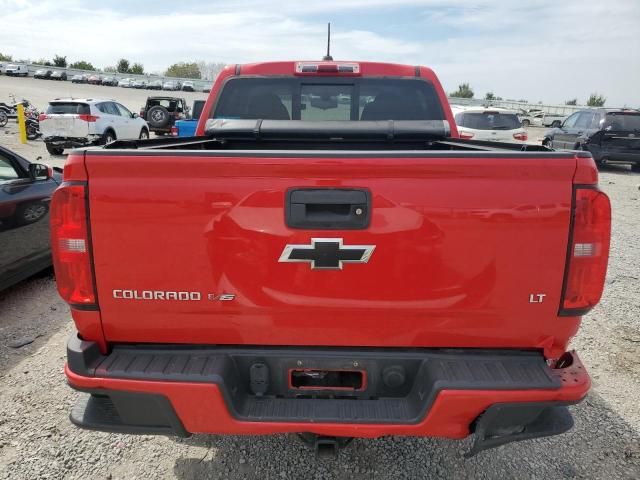 2017 Chevrolet Colorado LT