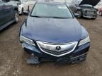 2015 Acura TLX Tech