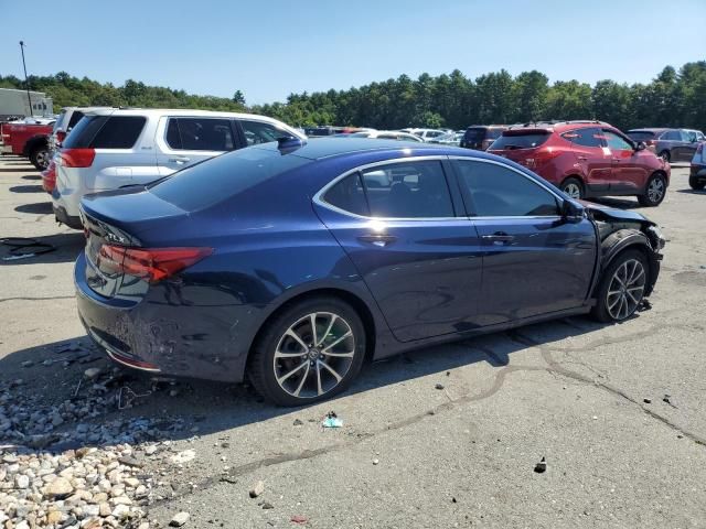 2015 Acura TLX Tech