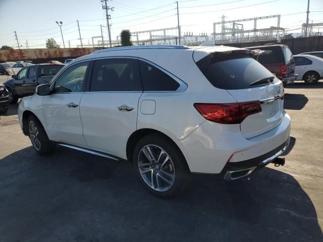 2017 Acura MDX Advance