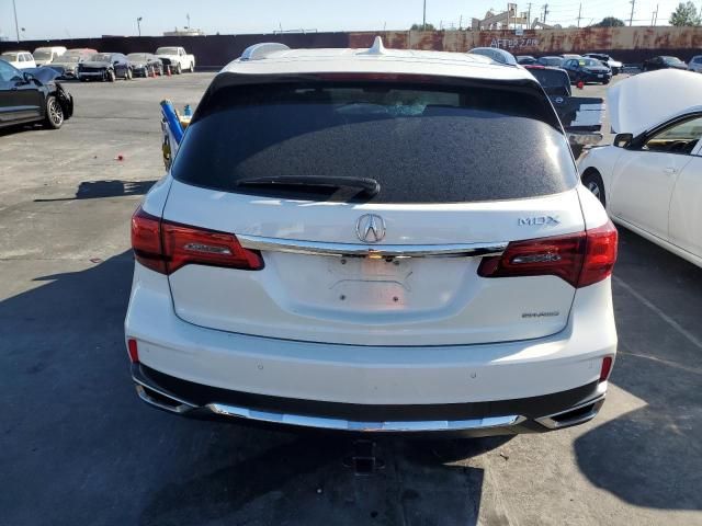 2017 Acura MDX Advance