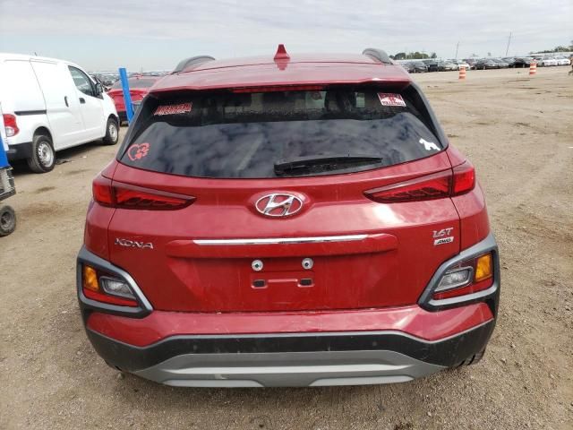 2020 Hyundai Kona Ultimate