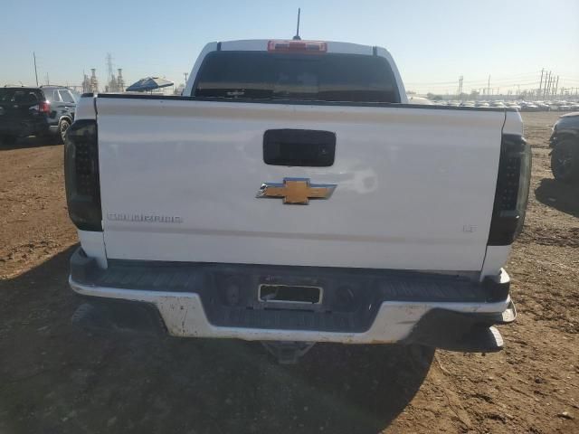 2015 Chevrolet Colorado