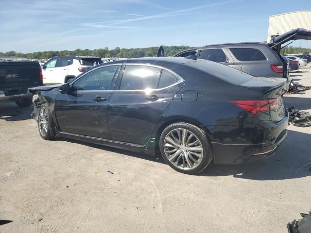 2017 Acura TLX Advance