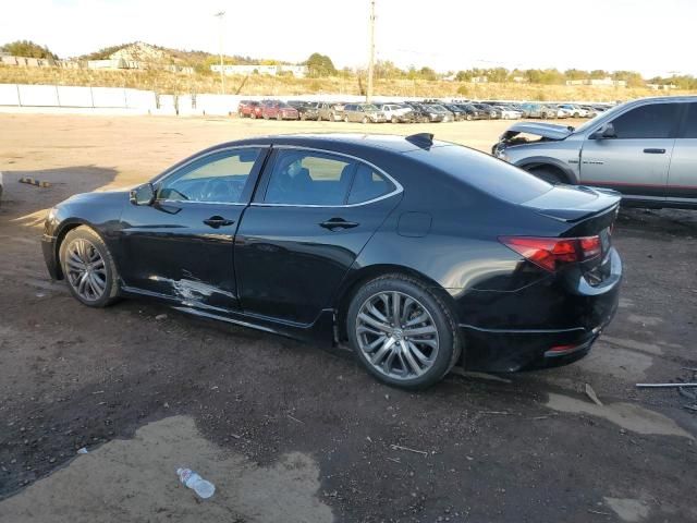 2015 Acura TLX Advance