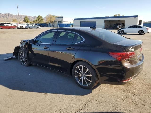 2017 Acura TLX Tech