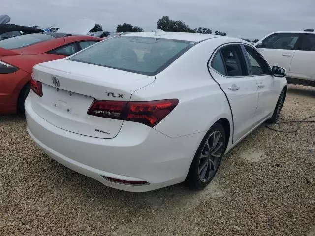 2017 Acura TLX Tech