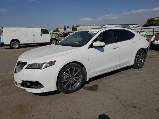 2015 Acura TLX Tech