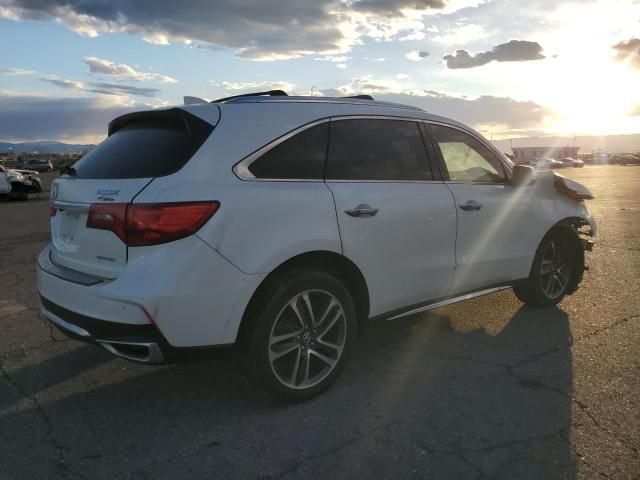 2017 Acura MDX Advance