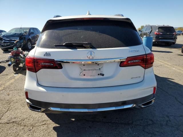 2017 Acura MDX Advance