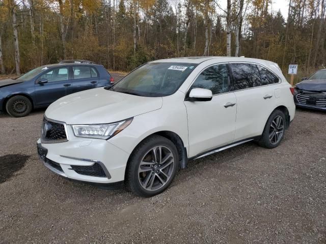 2017 Acura MDX Technology