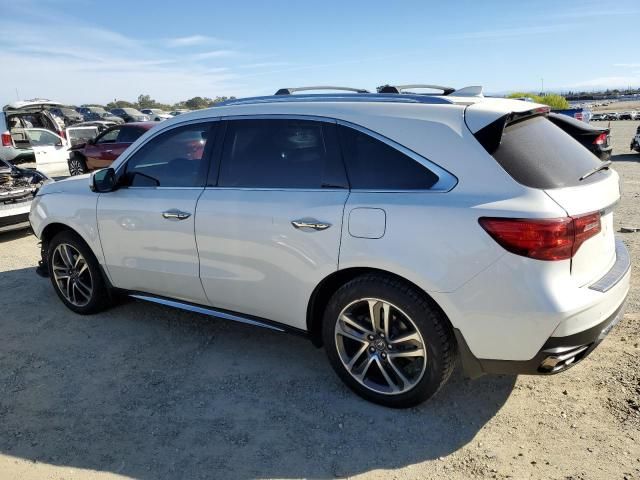 2017 Acura MDX Advance