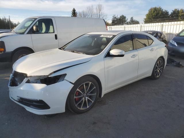 2015 Acura TLX Tech