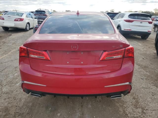 2018 Acura TLX Tech