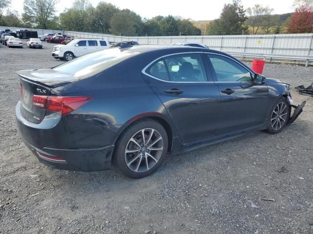 2017 Acura TLX Advance