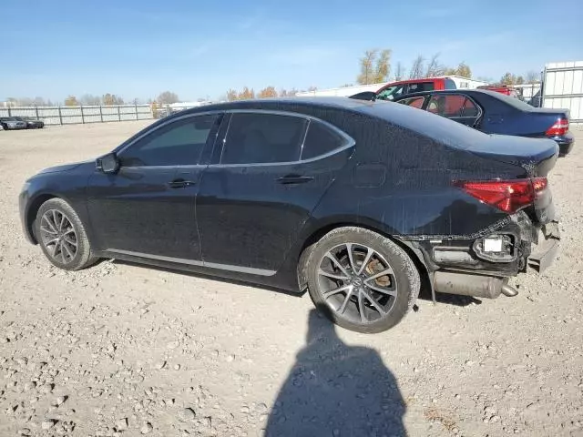 2015 Acura TLX Tech