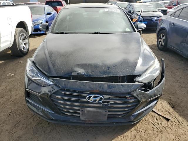 2017 Hyundai Elantra Sport