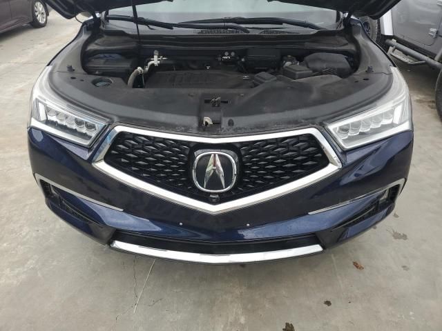 2017 Acura MDX Advance