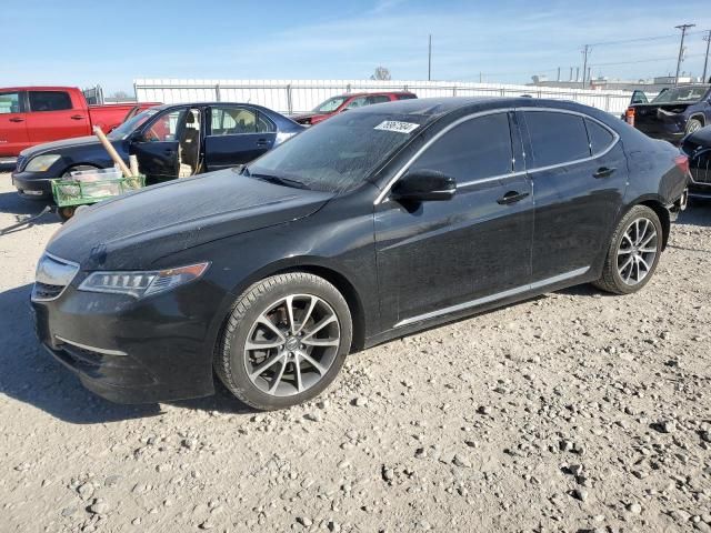 2015 Acura TLX Tech