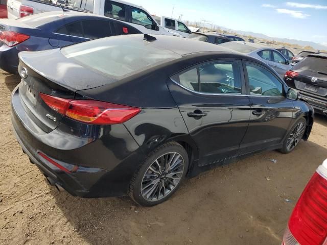 2017 Hyundai Elantra Sport