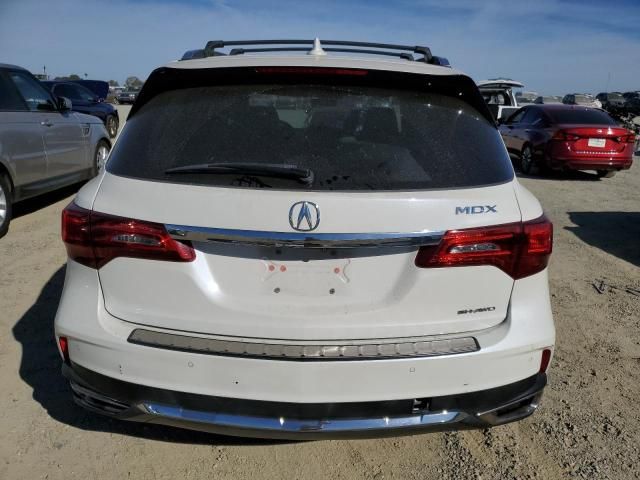 2017 Acura MDX Advance