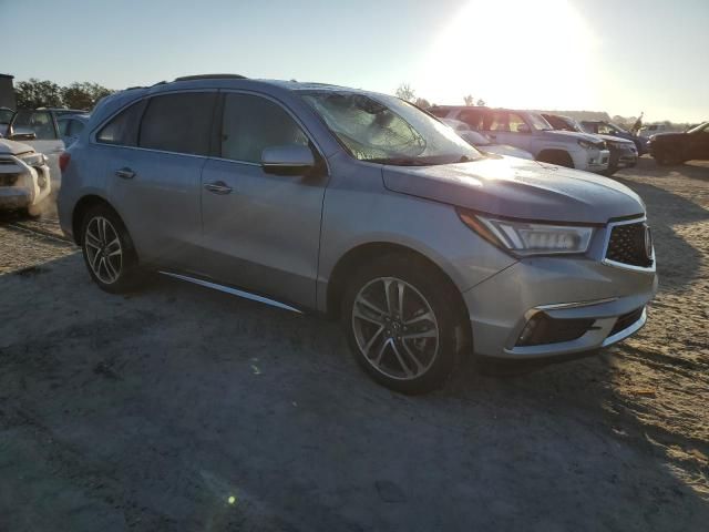 2017 Acura MDX Advance