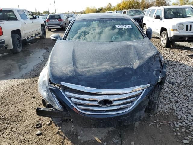 2014 Hyundai Sonata SE